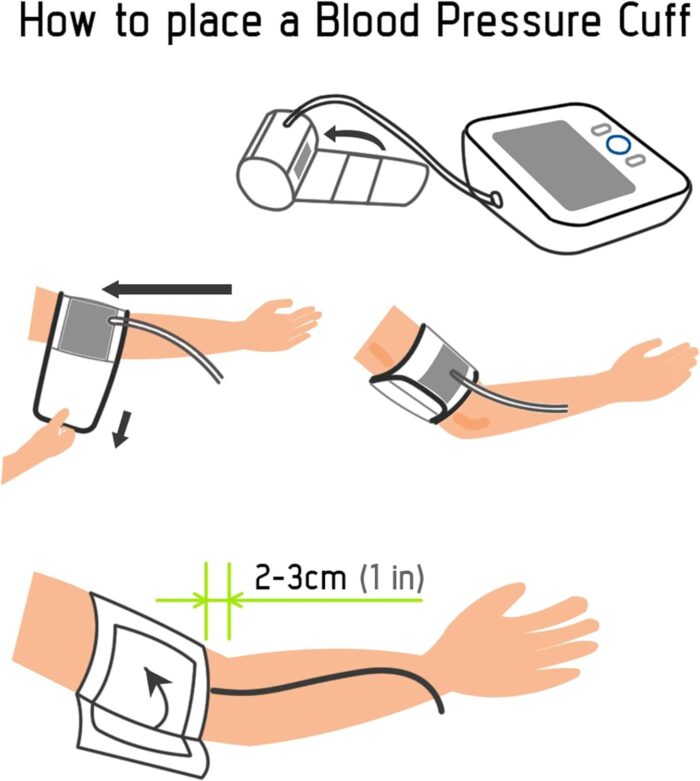 Blood Pressure Monitor